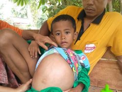 Tergolek Lemah, Bocah Malang Asal Kampar Kiri Berjuang Lawan Tumor Ganas