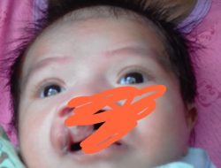 Bayi Malang Asal Kampar, Diduga Tak Terlayani BPJS