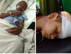 Pelaku Pembacokan Bertopeng Membacok Kepala Anak Kecil Hingga Otak Keluar