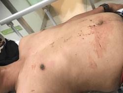 Gara Gara Rebutan Cewek Anak Kepala Daerah Lakukan Penganiayaan