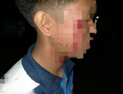 Terkait Kasus Penganiayaan Dilakukan Adik Anggota DPRD, Korban Minta Polisi Proses Secara Hukum
