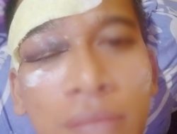 Jurnalis Media Online Babak Belur Dianiaya Oknum Ketua Ormas