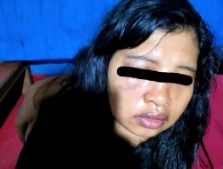 Oknum ASN di Taliabu Aniaya Mantan Pacar Hingga Babak Belur
