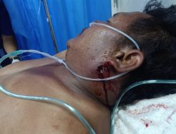 Jukir Penghalau Perampok Emas Terkapar