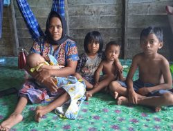 Butuh bantuan dari pemerintah , kondisi Devi Siregar sangat memprihatinkan
