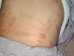 Biadab Anak Sekecil Itu Di pukuli Hingga Memar