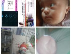 Donasi Untuk Rukaya,Bayi menderita Hydrocephalus ” Rp 10.000 atau berikan kami Doa”