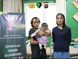 Rumah Sakit Bhayangkara Polda Sumbar Gelar Bakti Sosial Operasi Bibir Sumbing Gratis dalam Rangka HUT Bhayangkara ke-79