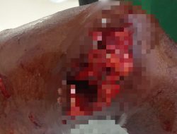 Hamzah (68) Diserang Buaya di Sei Lukut, Kapolsek Tualang Imbau Warga Hindari Sungai
